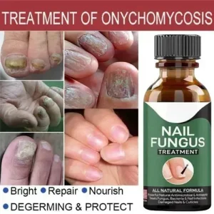 Nail Fungus Treatment Serum